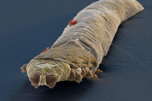 Demodex kleszcze: życie intropodów pasożytniczych